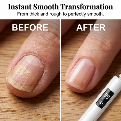 😋2026 HOT SALE😋💞 50K+ SOLD!💅✨49%OFF! Professional ElectricNail Polisher - Smoothsthick nails, 99-speeddisplay. Multiple headsfor shaping & buffing.Salon at home! ⭐💎